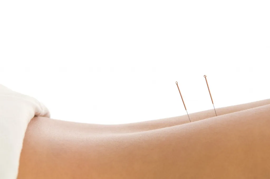 acupuncture osteohondroz -foto