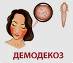 Демодекоз