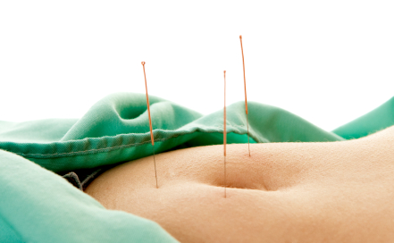 acupuncture weight loss-foto