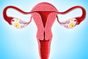 О нарушениях менструального цикла