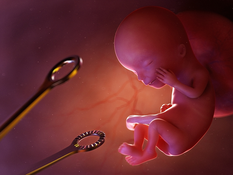 Каким бывает аборт, фото