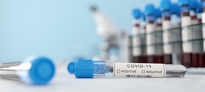 тест на коронавирус, фото
