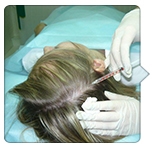 лечение волосистой части головы