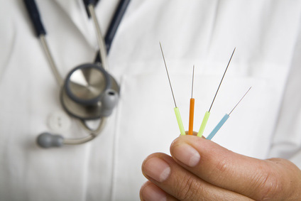 acupuncture needles PNS - foto